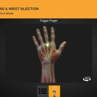 screenshot_20201027-161207_hand-wrist-injection